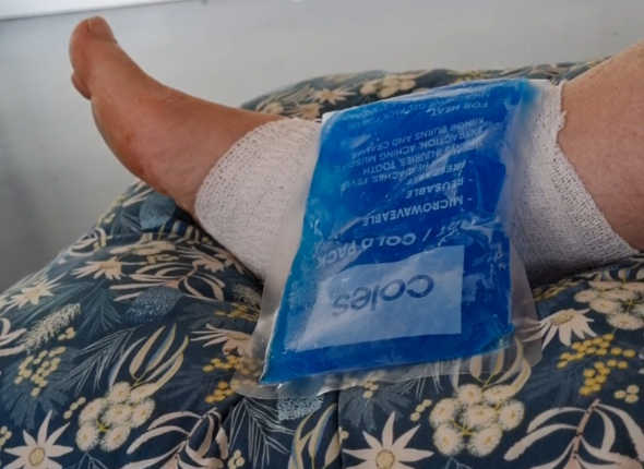 sprained ankle RICER